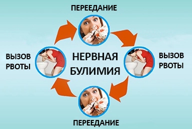 Лечение булимии в Свердловский